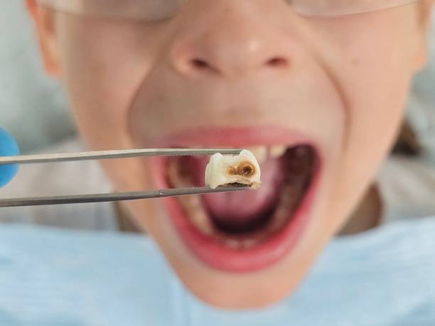 Best Pediatric Emergency Dentist in Washington, NJ